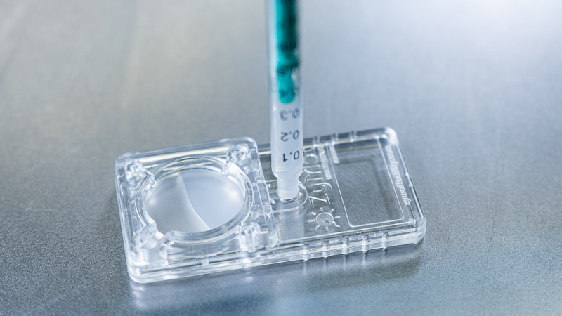 Sperm preparation in IVF Lab with ZyMot device